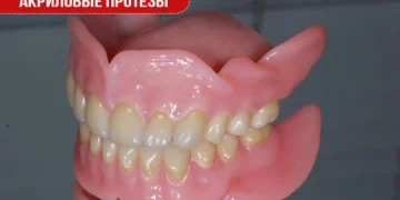 Акриловые протезы