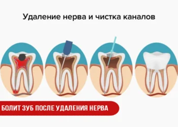 Болит зуб после удаления нерва