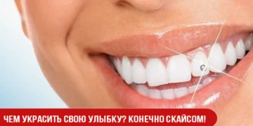 Чем украсить свою улыбку? Конечно скайсом!