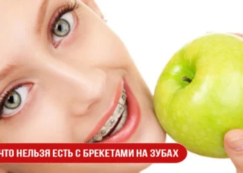 Что нельзя есть с брекетами на зубах
