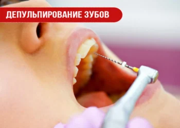 Депульпирование зубов