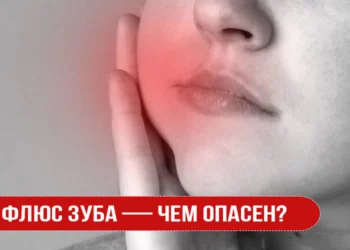 Флюс зуба — чем опасен?