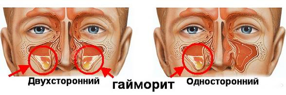Заболевания органов дыхания