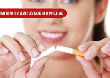 Имплантация зубов и курение