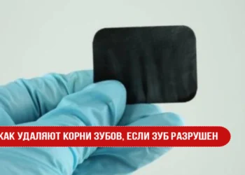 Как удаляют корни зубов, если зуб разрушен