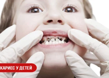Кариес у детей