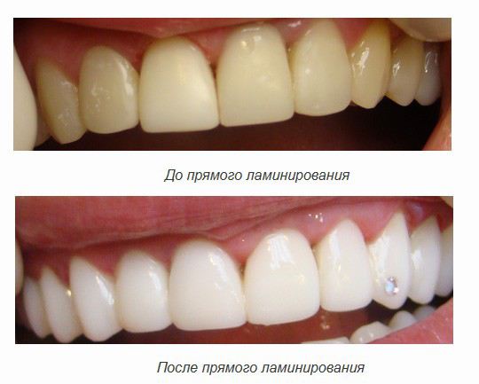 Ламинирование