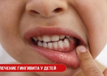 Лечение гингивита у детей