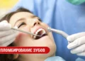Пломбирование зубов