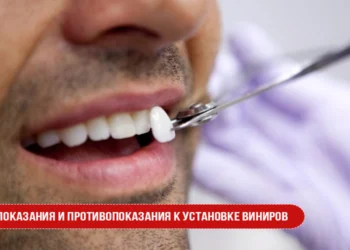 Показания и противопоказания к установке виниров