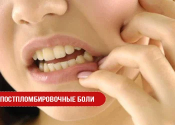 Постпломбировочные боли