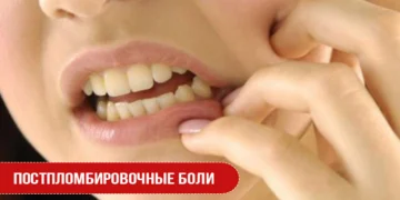 Постпломбировочные боли