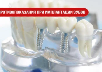 Противопоказания при имплантации зубов