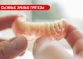 Съемные зубные протезы