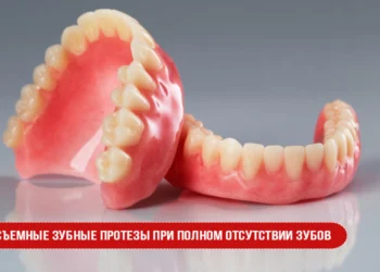 Съемные зубные протезы при полном отсутствии зубов