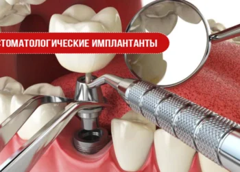 Стоматологические имплантанты