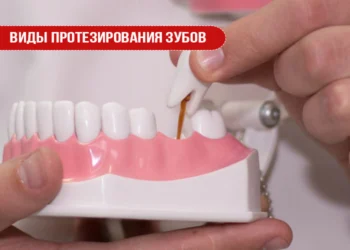 Виды протезирования зубов