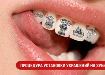Виды украшений зубов: скайсы, твинклс, наклейки, татуировки