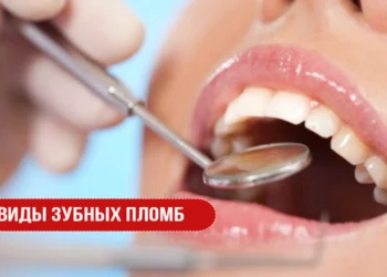 Виды зубных пломб